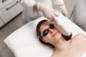 ipl-photofacial-recovery