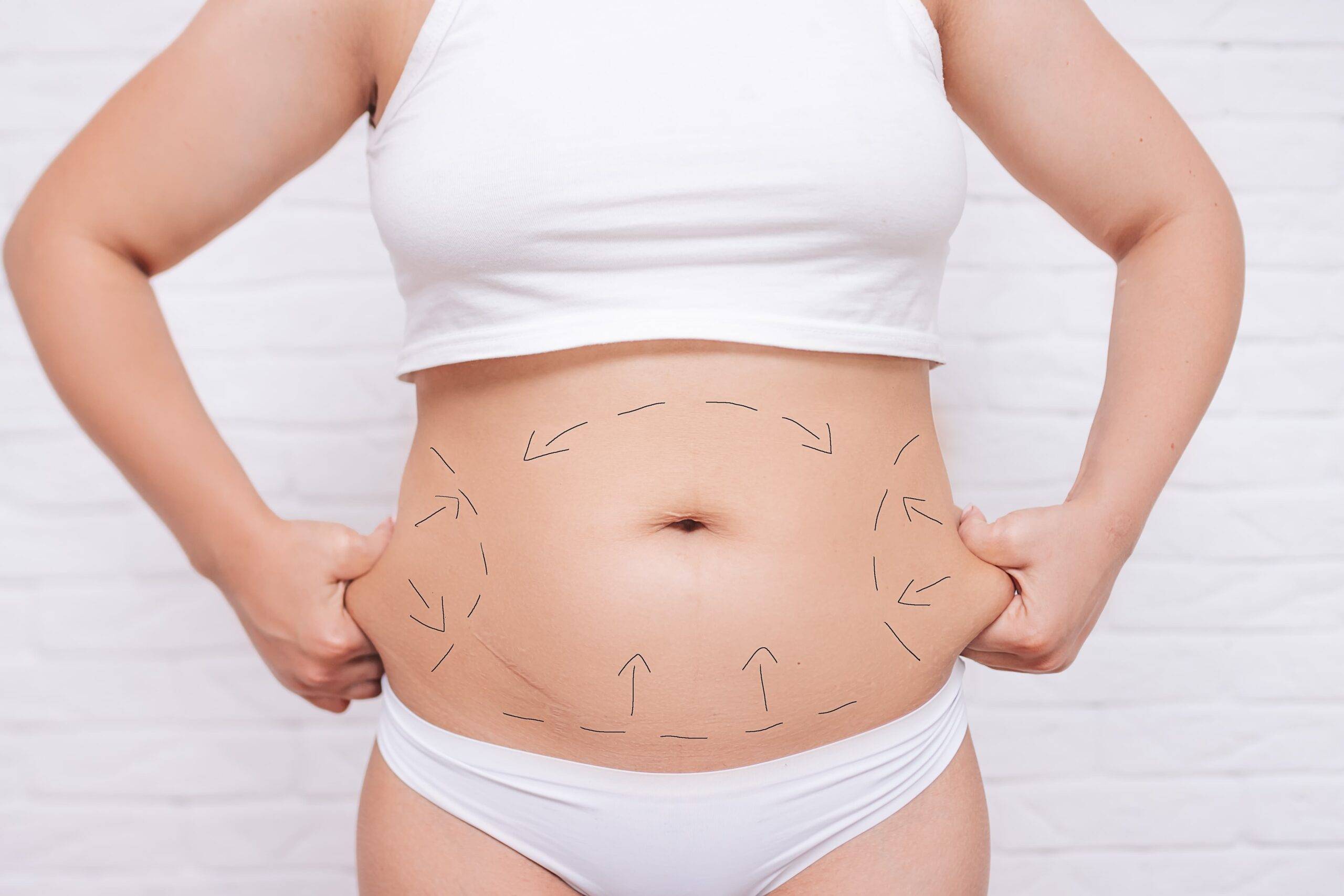 is SculpSure Painful?